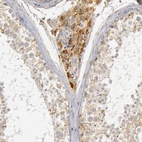 Immunohistochemical staining of human testis shows strong cytoplasmic positivity in Leydig cells.