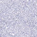 Anti-SMCO1 Antibody