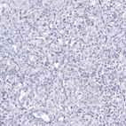 Immunohistochemical staining of human pancreas shows no positivity in glandular cells as expected.
