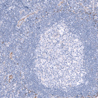 Anti-SMCO1 Antibody
