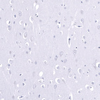 Immunohistochemical staining of human cerebral cortex shows no positivity in neurons as expected.
