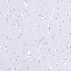 Anti-SMCO1 Antibody