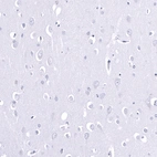 Immunohistochemical staining of human cerebral cortex shows no positivity in neurons as expected.
