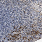 Immunohistochemical staining of human tonsil shows moderate cytoplasmic-membranous positivity in non-germinal center cells.