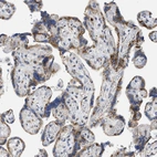 Immunohistochemical staining of human placenta shows moderate cytoplasmic-membranous positivity in trophoblastic cells.
