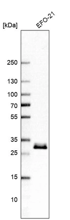 Western blot analysis in human cell line EFO-21.