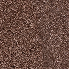 Immunohistochemical staining of human tonsil shows strong nuclear positivity in lymphoid cells.