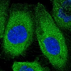 Immunofluorescent staining of human cell line A-431 shows positivity in plasma membrane & cytoplasm.