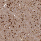 Anti-CUL5 Antibody