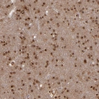 Immunohistochemical staining of human cerebral cortex shows strong nuclear positivity in neurons.