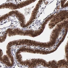 Immunohistochemical staining of human fallopian tube shows strong nuclear positivity in glandular cells.
