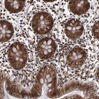 Immunohistochemical staining of human colon shows strong nuclear positivity in glandular cells.