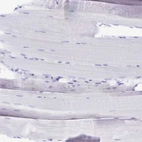 Immunohistochemical staining of human skeletal muscle shows no positivity in myocytes as expected.