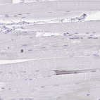 Immunohistochemical staining of human skeletal muscle shows no positivity in myocytes as expected.