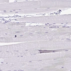 Immunohistochemical staining of human skeletal muscle shows no positivity in myocytes as expected.