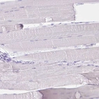 Immunohistochemical staining of human skeletal muscle shows no positivity in myocytes as expected.