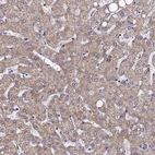 Immunohistochemical staining of human liver shows moderate cytoplasmic granular positivity in hepatocytes.