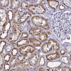 Immunohistochemical staining of human kidney shows strong cytoplasmic granular positivity in cells in tubules.