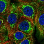 Immunofluorescent staining of human cell line MCF7 shows localization to cytosol & mitochondria.