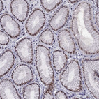 Immunohistochemical staining of human stomach shows moderate nuclear positivity in glandular cells.