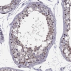 Immunohistochemical staining of human testis shows moderate nuclear positivity in cells in seminiferous ducts.