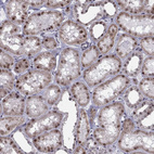 Anti-RPRD2 Antibody