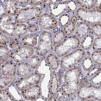 Immunohistochemical staining of human kidney shows moderate cytoplasmic-nuclear positivity in cells in tubules.