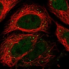 Immunofluorescent staining of human cell line SiHa shows localization to nucleoplasm & vesicles.
