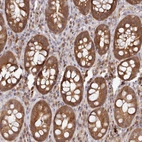 Immunohistochemical staining of human rectum shows strong cytoplasmic positivity in glandular cells.