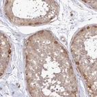 Immunohistochemical staining of human testis shows moderate cytoplasmic positivity in cells in seminiferous ducts.