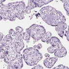 Immunohistochemical staining of human placenta shows no positivity in trophoblastic cells as expected.