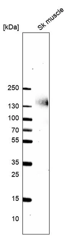 Western blot analysis in human skeletal muscle tissue.