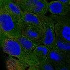 Immunofluorescent staining of human cell line RT4 shows localization to plasma membrane, cytosol & lipid droplets.