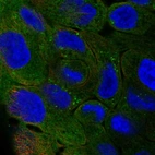 Immunofluorescent staining of human cell line RT4 shows localization to plasma membrane, cytosol & lipid droplets.