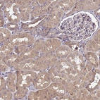 Immunohistochemical staining of human kidney shows moderate cytoplasmic positivity in cells in tubules.