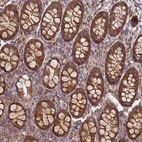 Immunohistochemical staining of human colon shows strong cytoplasmic positivity in glandular cells.
