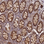 Immunohistochemical staining of human colon shows strong cytoplasmic positivity in glandular cells.