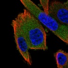 Immunofluorescent staining of human cell line PC-3 shows localization to cytosol.