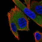 Immunofluorescent staining of human cell line PC-3 shows localization to cytosol.