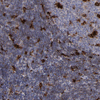 Immunohistochemical staining of human lymph node shows strong cytoplasmic granular positivity in a subset of non-germinal center cells.and germinal center cells