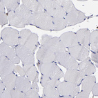 Immunohistochemical staining of human skeletal muscle shows no positivity in myocytes as expected.