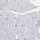 Immunohistochemical staining of human skeletal muscle shows no positivity in myocytes as expected.