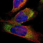 Immunofluorescent staining of human cell line U-2 OS shows localization to vesicles.