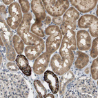 Immunohistochemical staining of human kidney shows strong cytoplasmic positivity in cells in tubules.