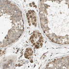 Immunohistochemical staining of human testis shows strong cytoplasmic positivity in Leydig cells.