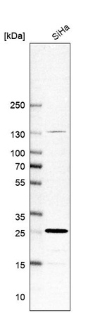 Western blot analysis in human cell line SiHa.