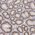 Immunohistochemical staining of human stomach shows strong positivity in cytoplasm granular-membranous in glandular cells.