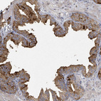 Anti-WDFY1 Antibody