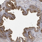 Immunohistochemical staining of human prostate shows strong cytoplasmic positivity in glandular cells.