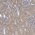 Immunohistochemical staining of human kidney shows strong cytoplasmic positivity in cells in tubules.